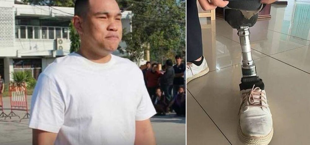 ผบ.ตร. เซ็นคืนสิทธิให้ ส.ต.อ. สอบติดนายร้อย แต่ถูกปัดตกเพราะขาเทียม