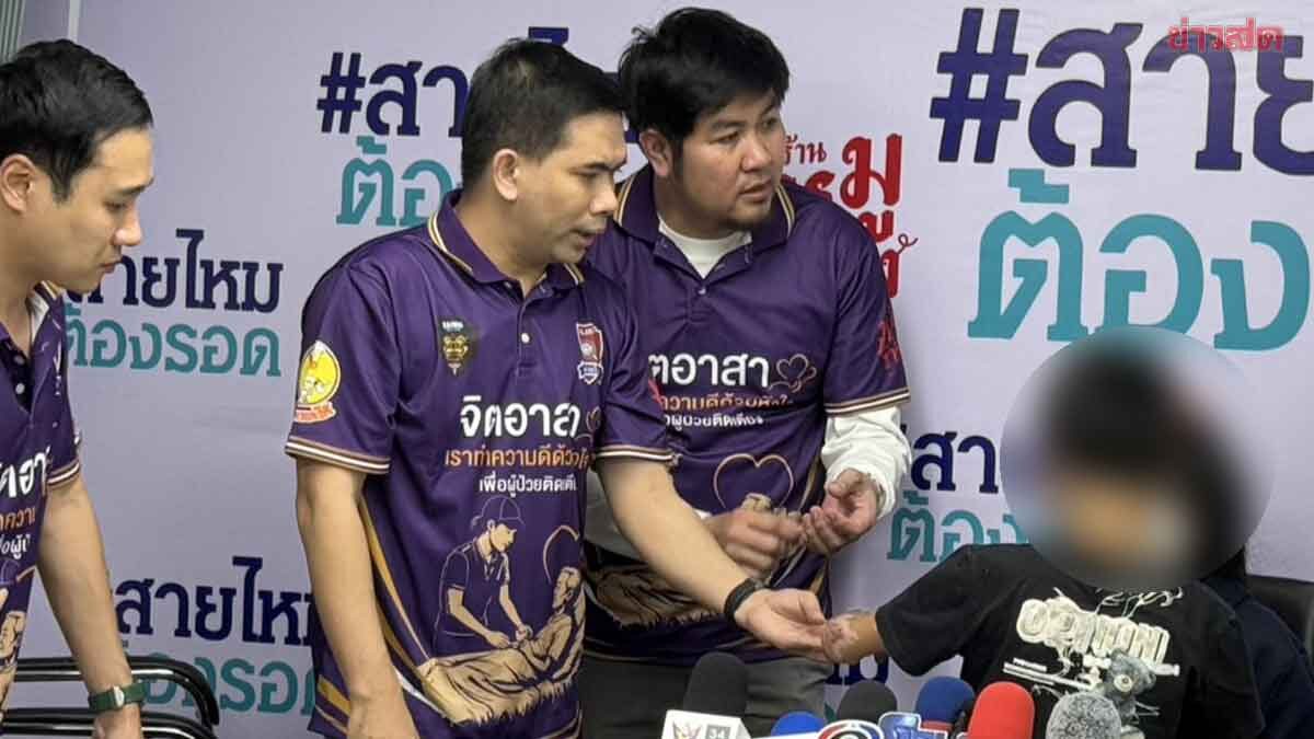 แม่ร้องครูใช้ลูกป.5 จุดไฟเผาไล่รังแตน เกิดพลาดระเบิดตูมสนั่น ไฟลุกคลอกทั่วร่างกาย