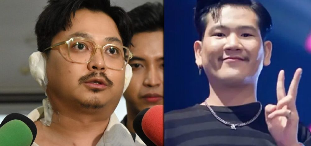 หัวหน้าวงทศกัณฐ์ เผย ‘ดิน’ นักร้องนำยังอาการทรงตัว ถูกไฟคลอก 80 % แม่เผยลูกชายสู้อยู่แล้ว